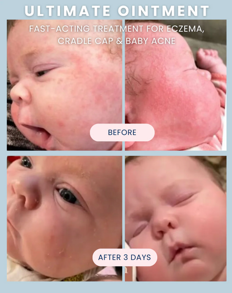 Ultimate Baby Ointment