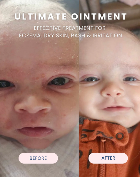 Ultimate Baby Ointment